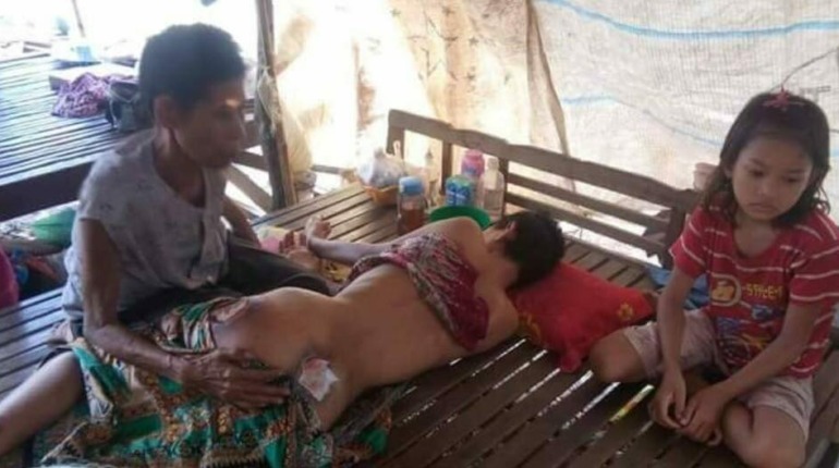 កាលពីថ្ងៃអាទិត្យ ទី២២ ខែឧសភា ឆ្នាំ២០១៦ ក្រុមការងារមូលនិធិរក្សាកុមារ តាងនាមលោកជំទាវ ជា សិរី និងស្ថាបនិកមូលនិធិរក្សាកុមារ បាននាំយកអំណោយជាទឹកប្រាក់ចំនួន ៥០០.០០០រៀល ជូនដល់បងស្រី ដេត ស្រីម៉ៅ…